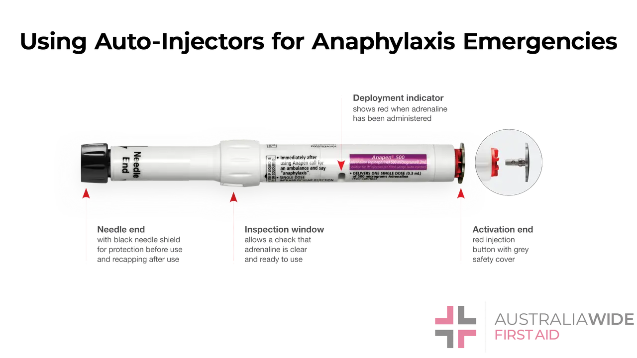 Gain the knowledge necessary to administer life-saving treatment and provide effective anaphylaxis first aid in allergy emergencies.